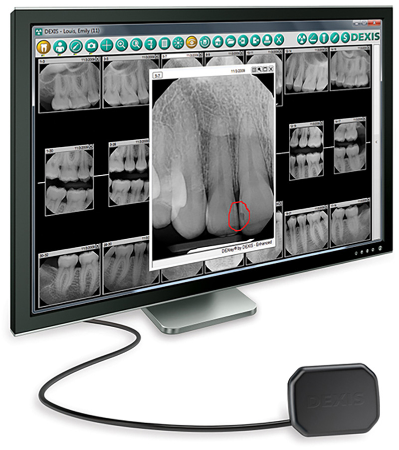 Digital xray at Portland Perio Implant Center