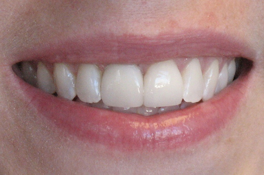 patient's beautiful smile after dental treatment