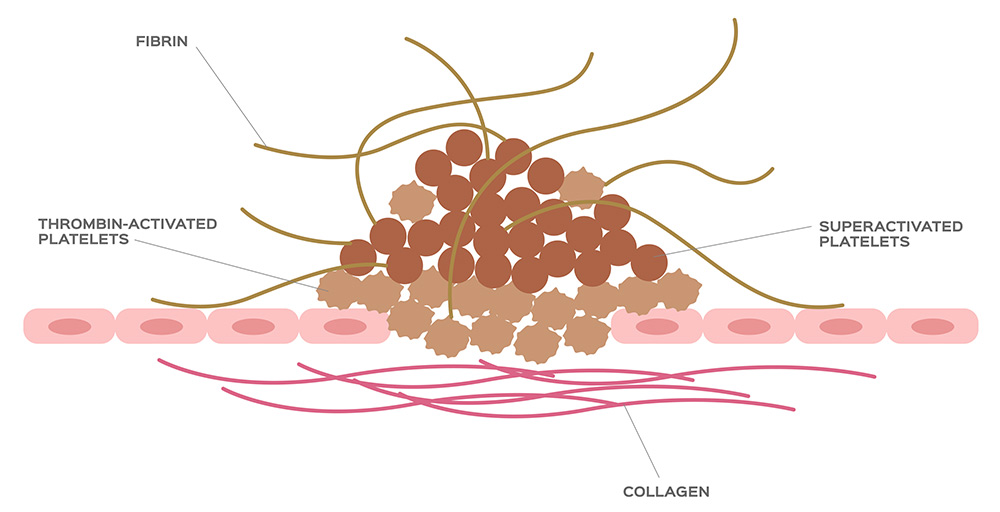 Platelet Rich Fibrin - PFR Regeneration