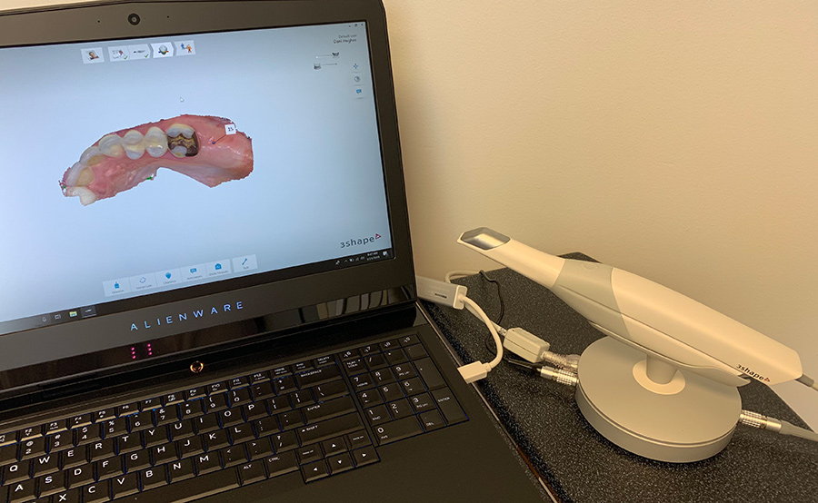 3Shape TRIOS Intraoral Scanner with sample results shown on screen