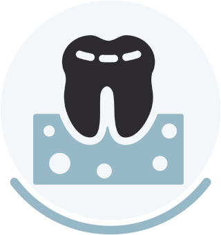 Gum Grafting for Dental Implants