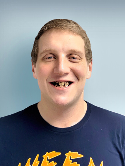 Before All-On-4 Dental Implants - Bob Cranswick