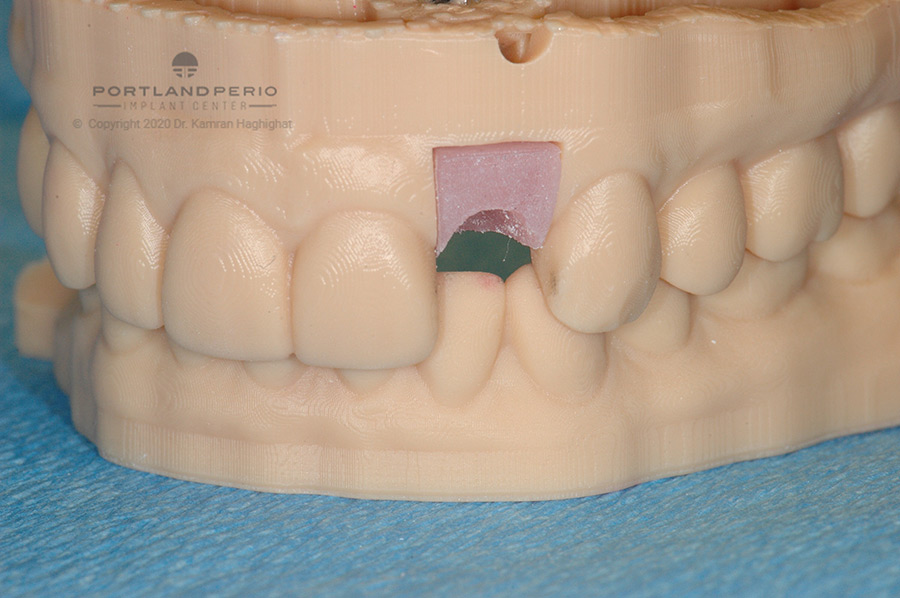 Printed 3D model of tooth