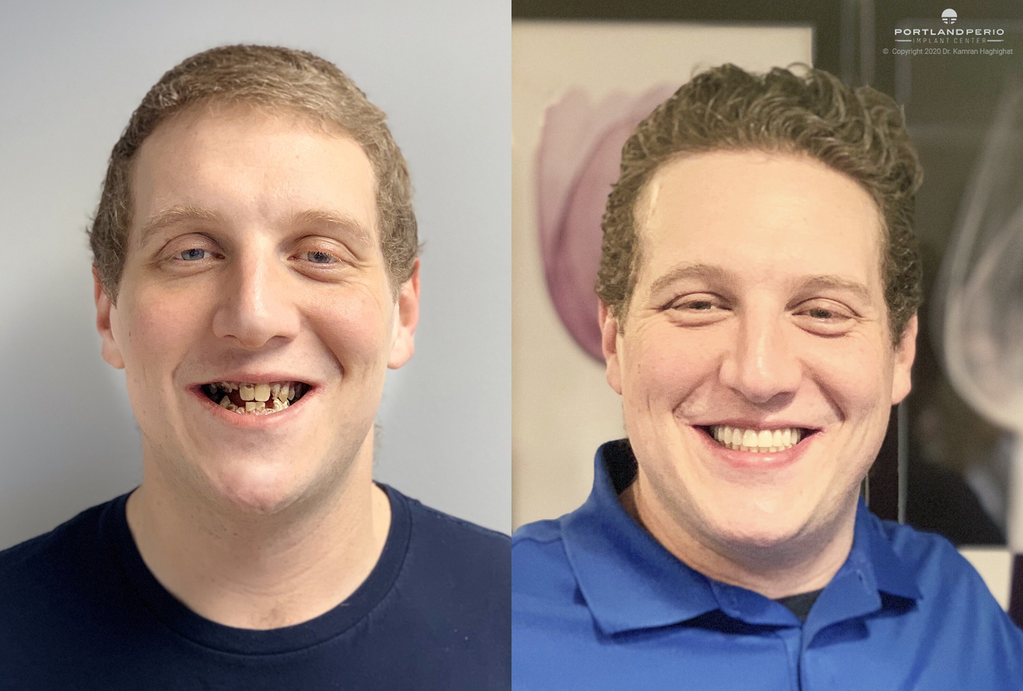 Bob-face-before-after-2