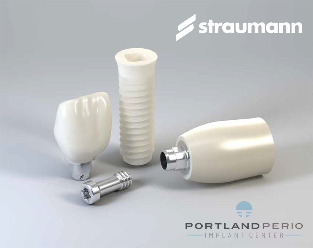 Straumann® PURE Ceramic Implants Portland Perio Implant Center