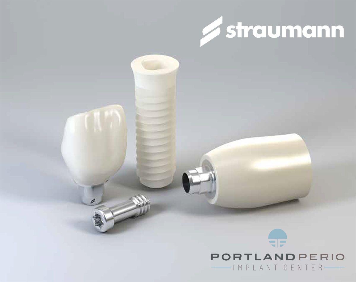 Straumann PURE Ceramic Implants - Portland Perio Implant Center - Portland, OR
