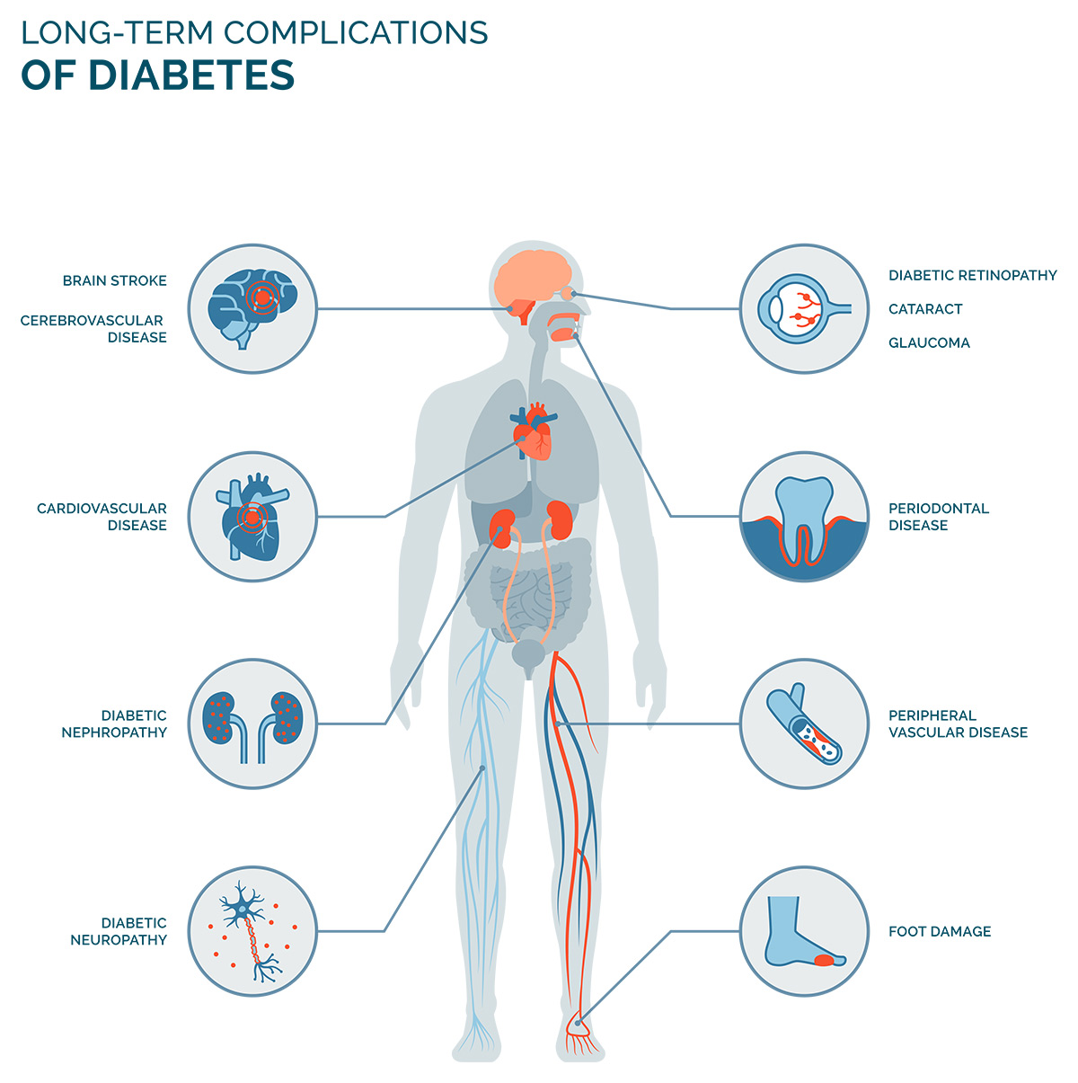 Diabetes Mellitus and Periodontitis