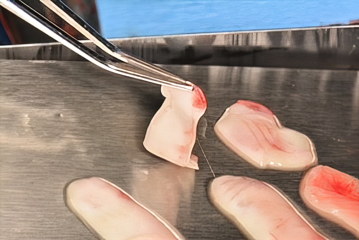 Accelerating Healing Naturally: The Use of PRP and L-PRF in Surgical Dentistry - Dr. Kamran Haghighat - Portland Perio Implant Center