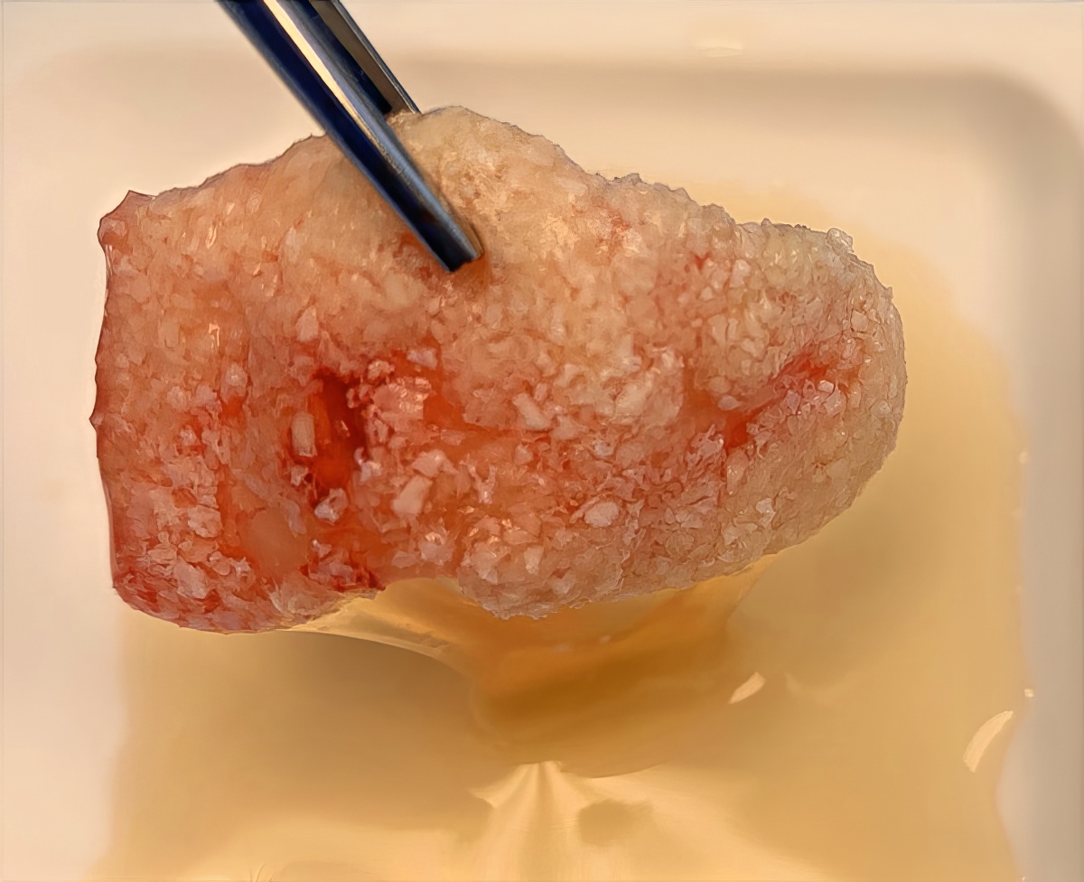 Accelerating Healing Naturally: The Use of PRP and L-PRF in Surgical Dentistry - Dr. Kamran Haghighat - Portland Perio Implant Center