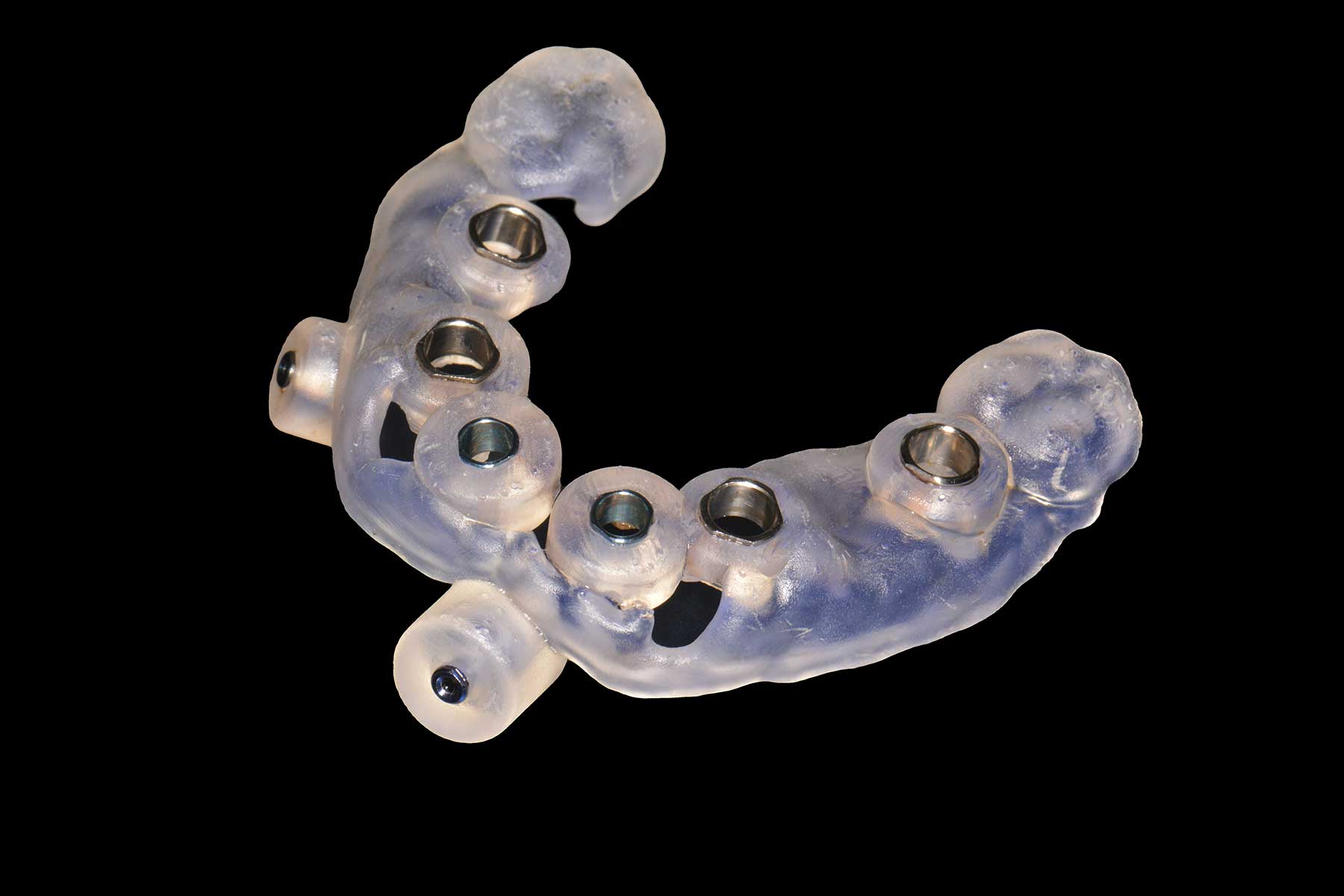 Lower jaw digital smile design showing implant placement for full arch dental rehabilitation with Dr. Kamran Haghighat