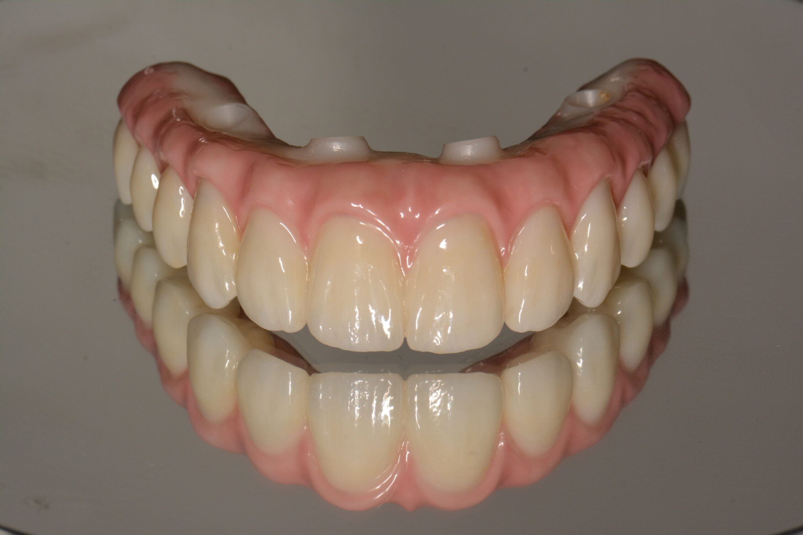 Double Arch All On 4 Rehabilitation with Zirconia and Titanium Framework Prosthesis - Portland Perio Implant Center - Dr. Kamran Haghighat